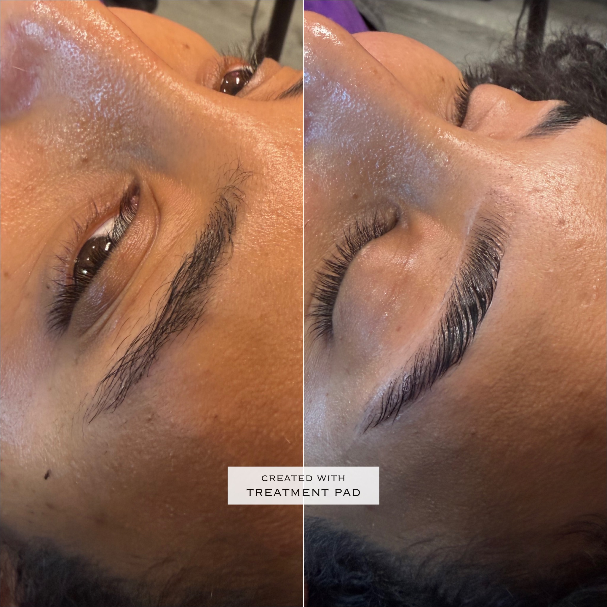 Brow before-and-after comparison from Solis