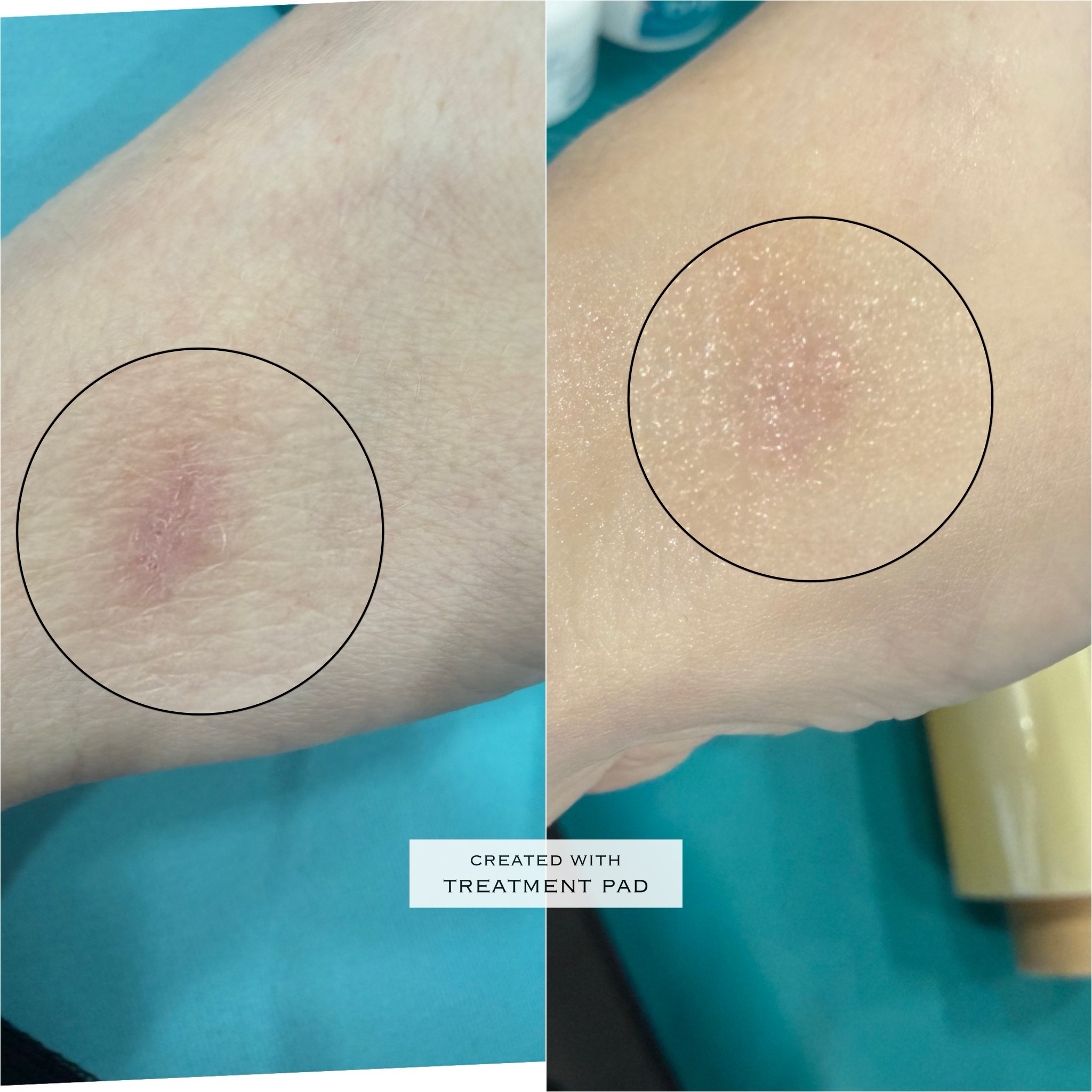 Skin lightening before-and-after comparison from Solis