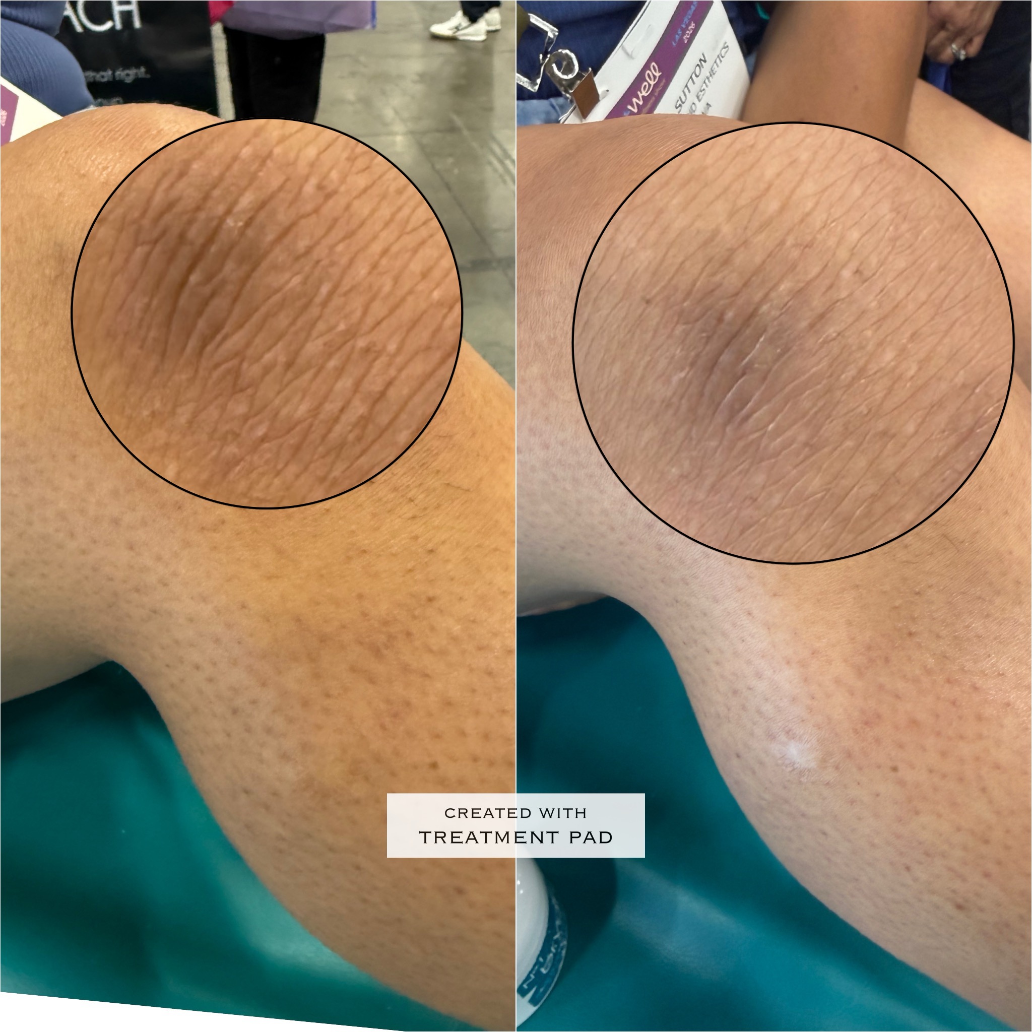 Skin lightening before-and-after comparison from Solis