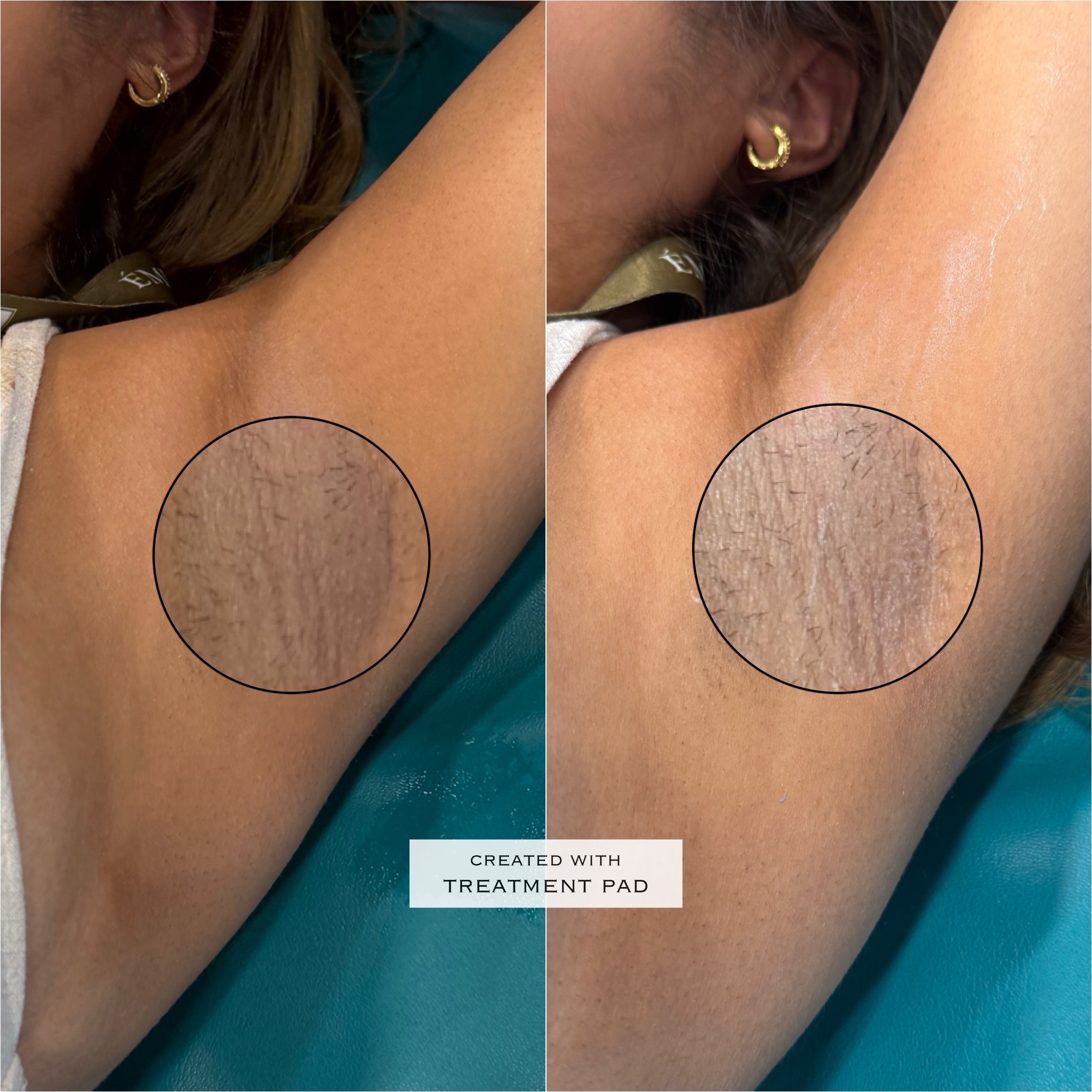 Skin lightening before-and-after comparison from Solis