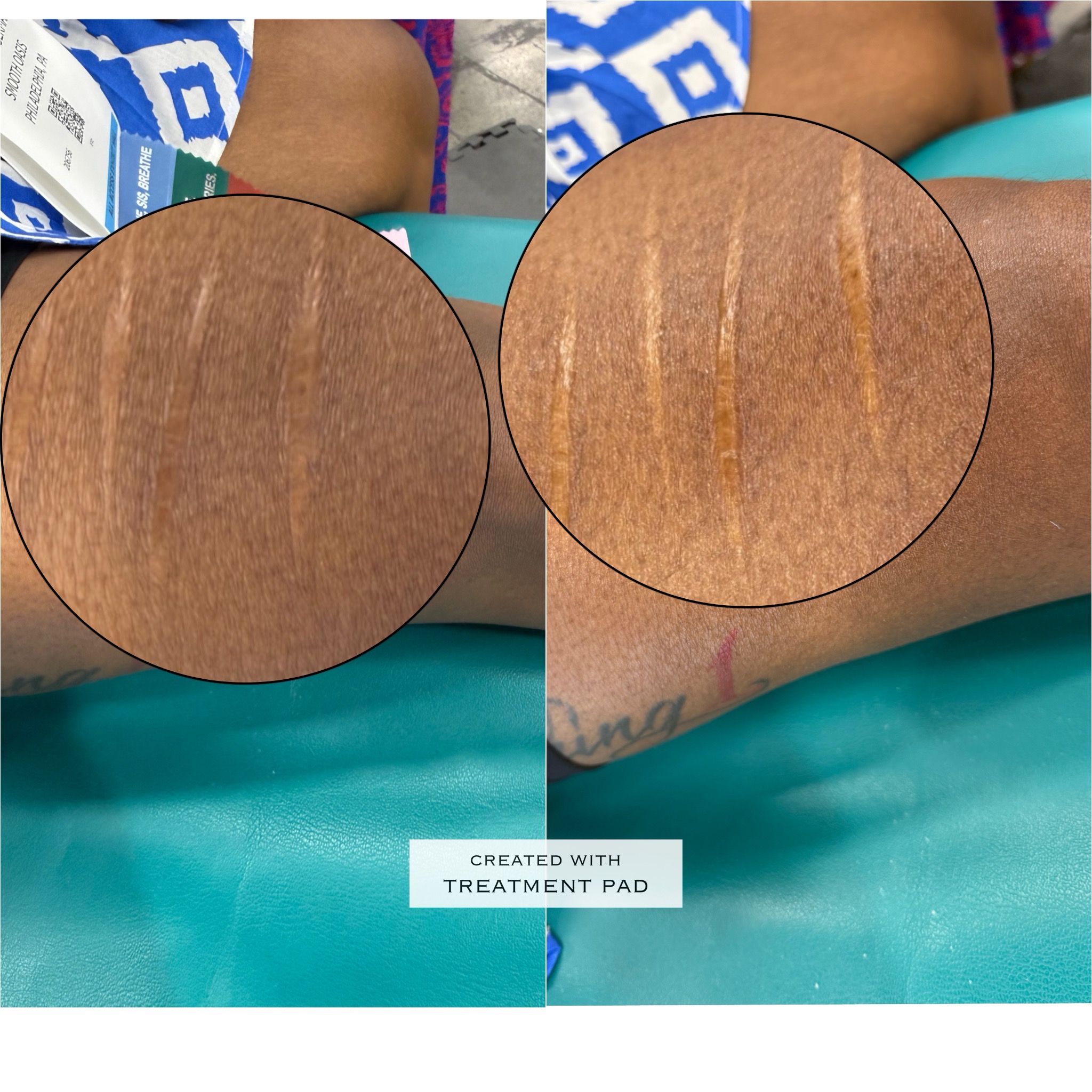 Skin lightening before-and-after comparison from Solis