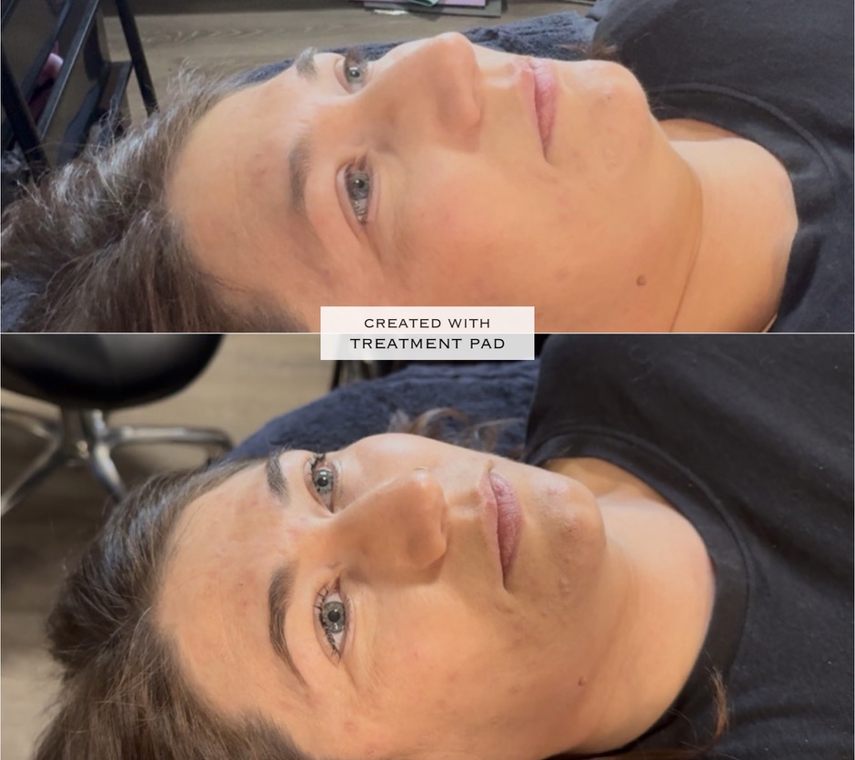 Brows & lashes before-and-after comparison from Solis