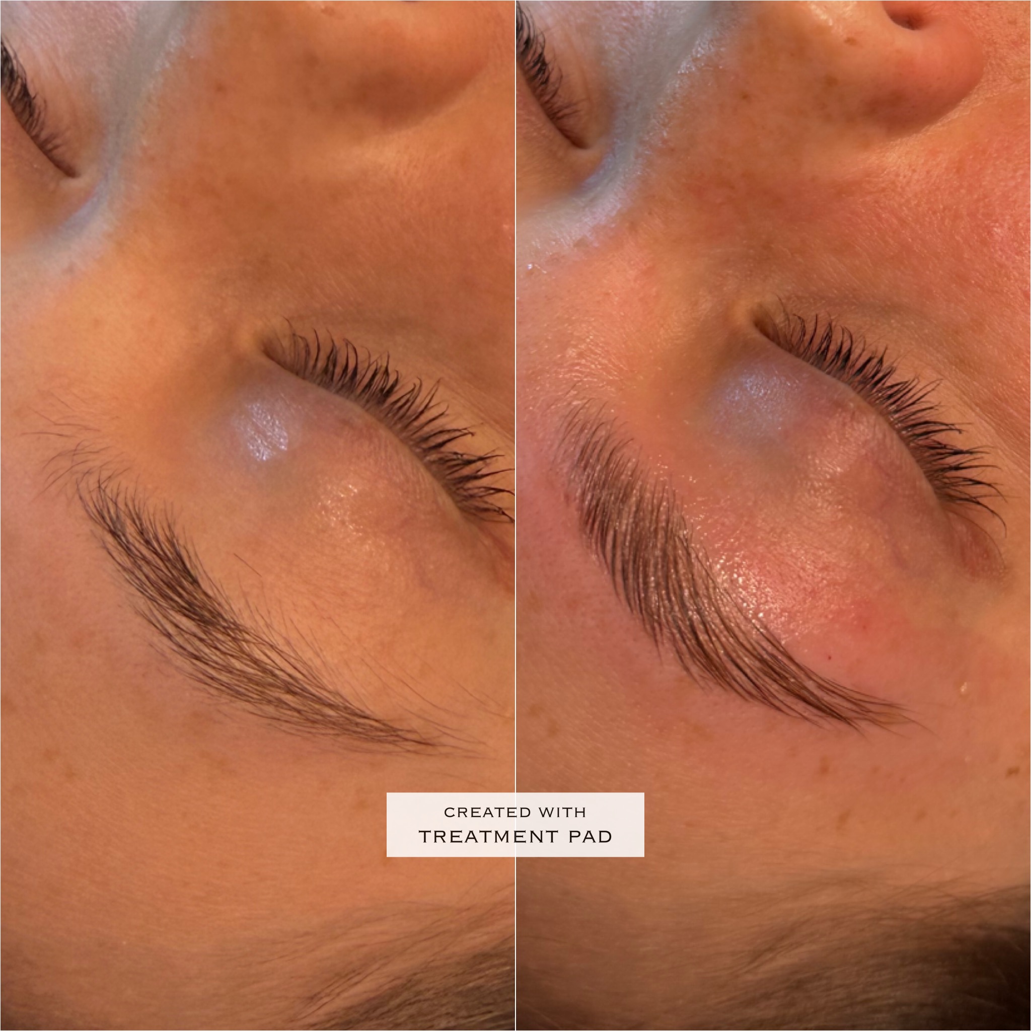 Brow waxing before-and-after comparison from Solis