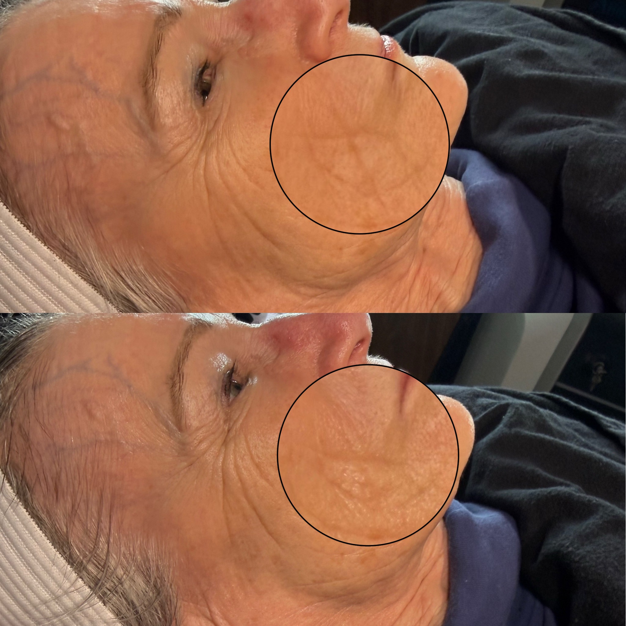 Jet Plasma before-and-after comparison from Solis