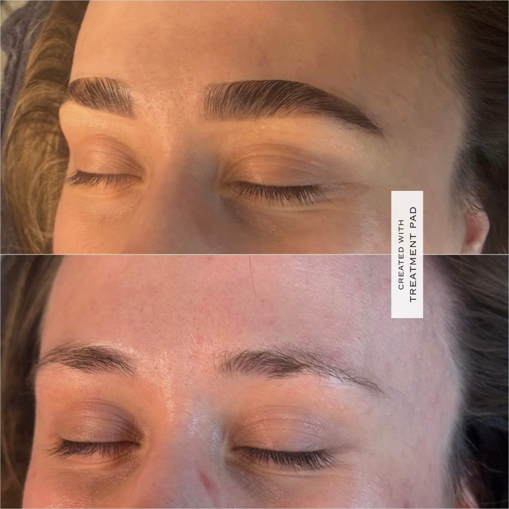 Brows & lashes before-and-after comparison from Solis