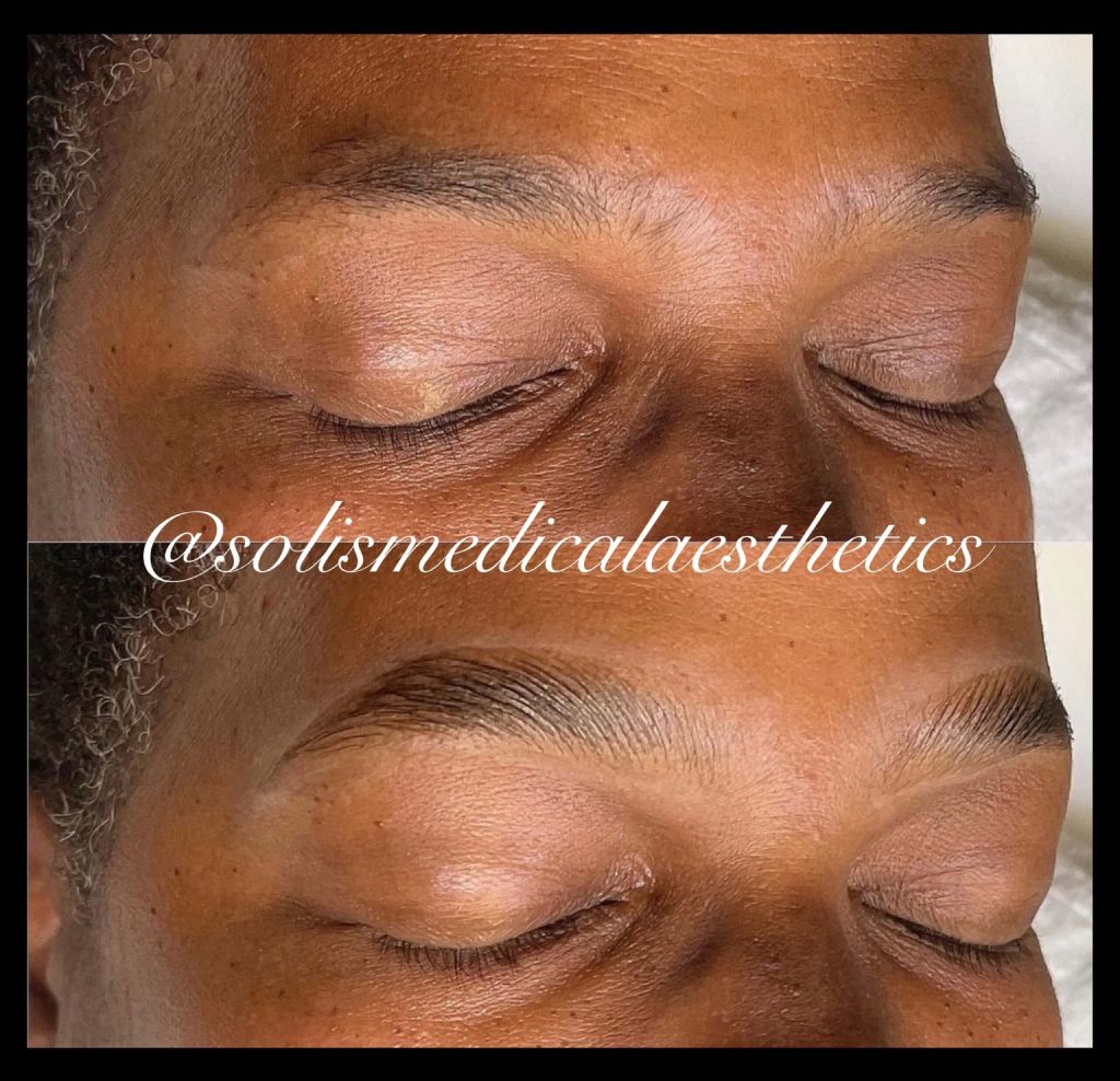 Brows & lashes before-and-after comparison from Solis