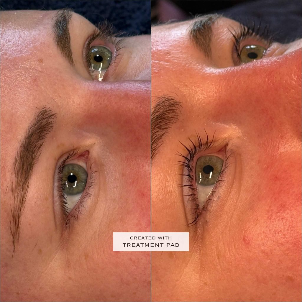 Brows & lashes before-and-after comparison from Solis