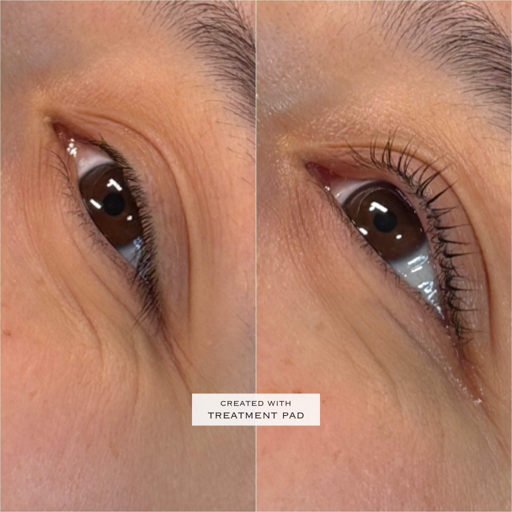 Brows & lashes before-and-after comparison from Solis